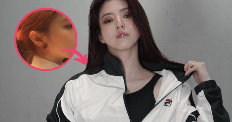 Actress Han So Hee Recently Underwent Nose Surgery — Here’s Why She Decided To Do It