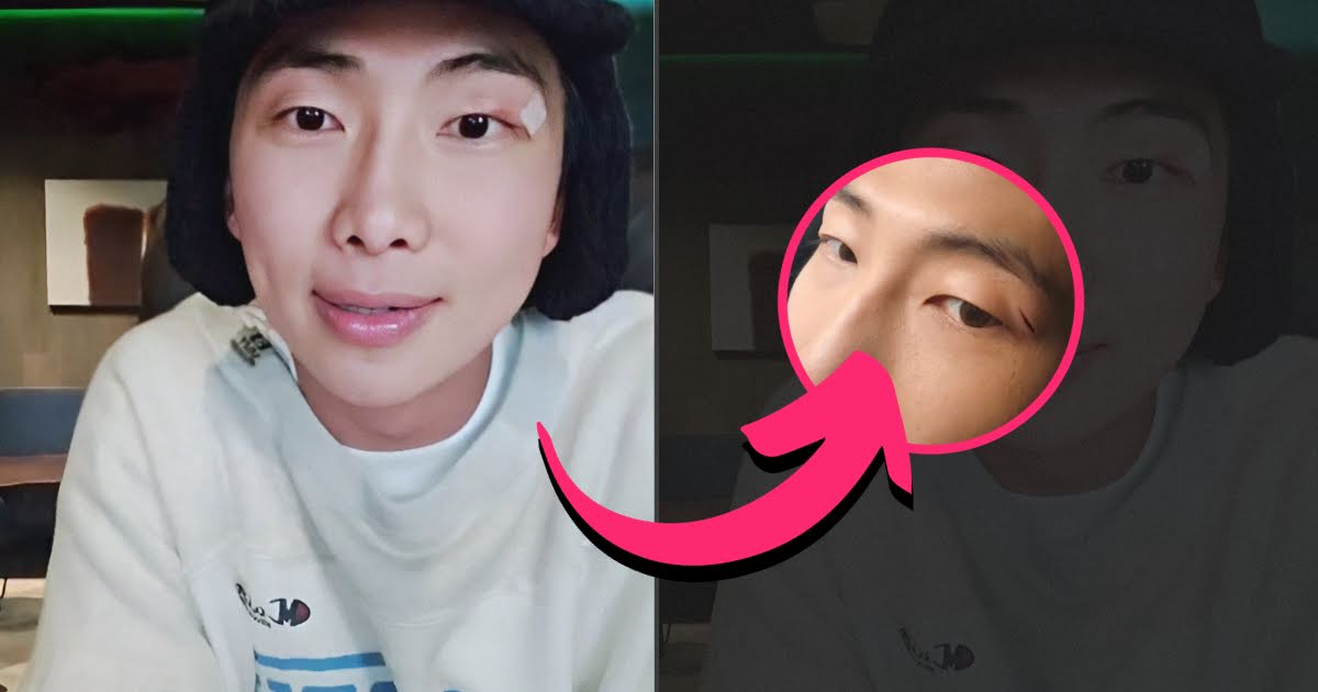 BTS’s RM Updates Fans About His Latest Injury