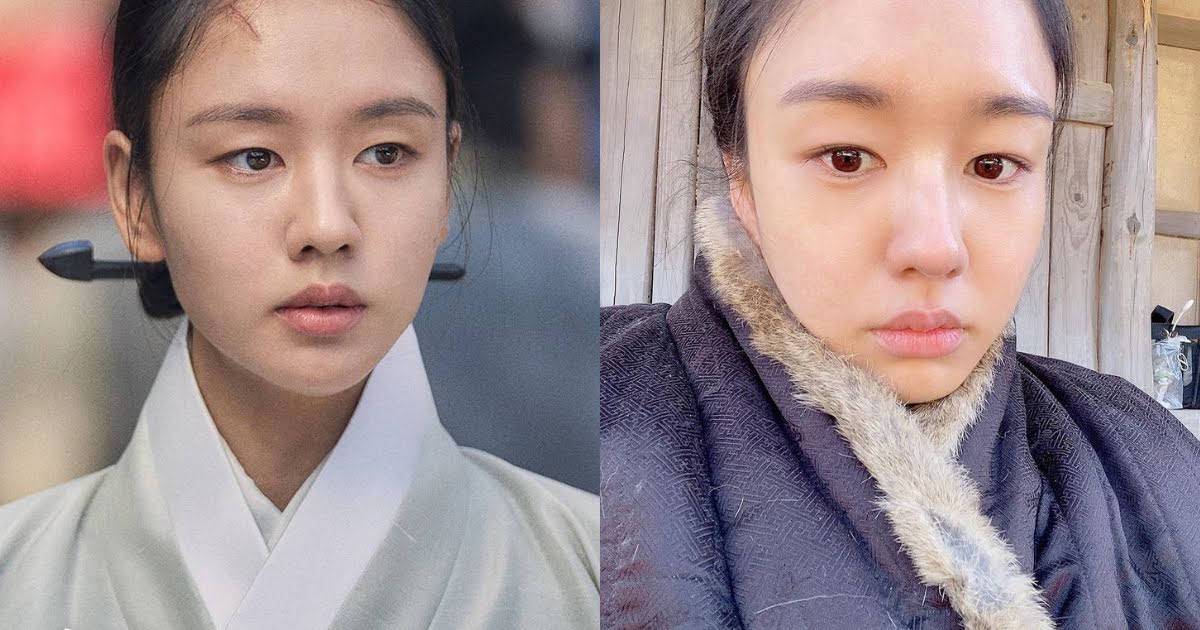 Actress Ahn Eun Jin Gets Facial Paralysis While Filming K-Drama “My Dearest”