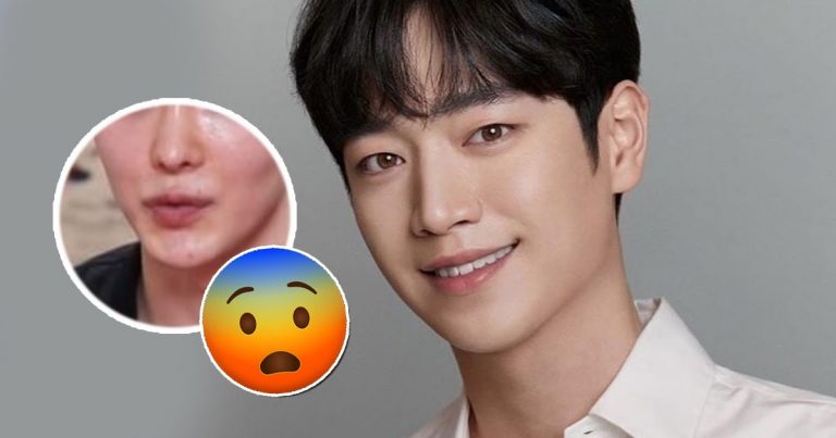 Korean Man’s Look-Alike Plastic Surgeries Left Him Looking Unrecognizable