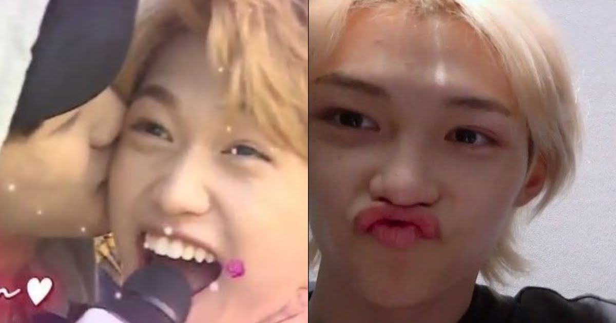 Stray Kids’ Felix Does Not Want To Be Kissed