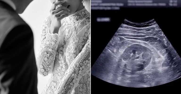 Newlywed Actress Thrills Fans With Surprise Pregnancy Announcement