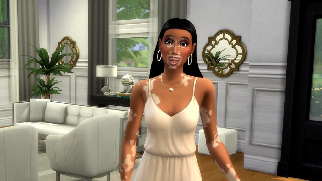 ‘The Sims 4’ Announces Collaboration With Supermodel Winnie Harlow, Introduces Vitiligo Skin Feature