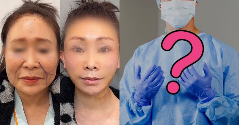 TikTok’s Dr. Kim Goes Viral For “Botched” Plastic Surgery Results, Unlocking A Twisted Back Story