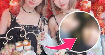 How The Japanese Twins Who Spent $315,000 On Plastic Surgery Looked Before Their Transformation