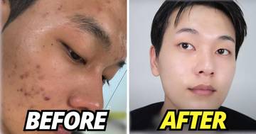 Korean YouTuber Transforms His Skin With 8 Easy Tips