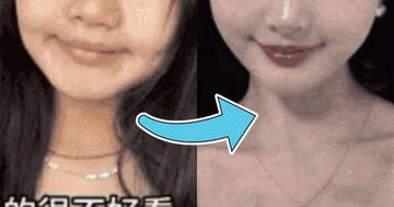 Extreme Plastic Surgery Leaves Woman Looking Completely Unrecognizable