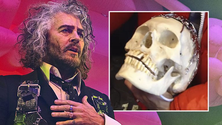 “The song is about death. It came inside an actual dead person’s skull”: When The Flaming Lips proved they love you with a Halloween track lasting 24 hours