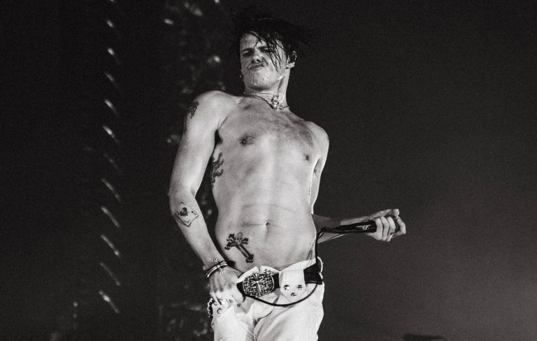 Yungblud breaks his leg in motorbike accident, vows to still play European festivals this week