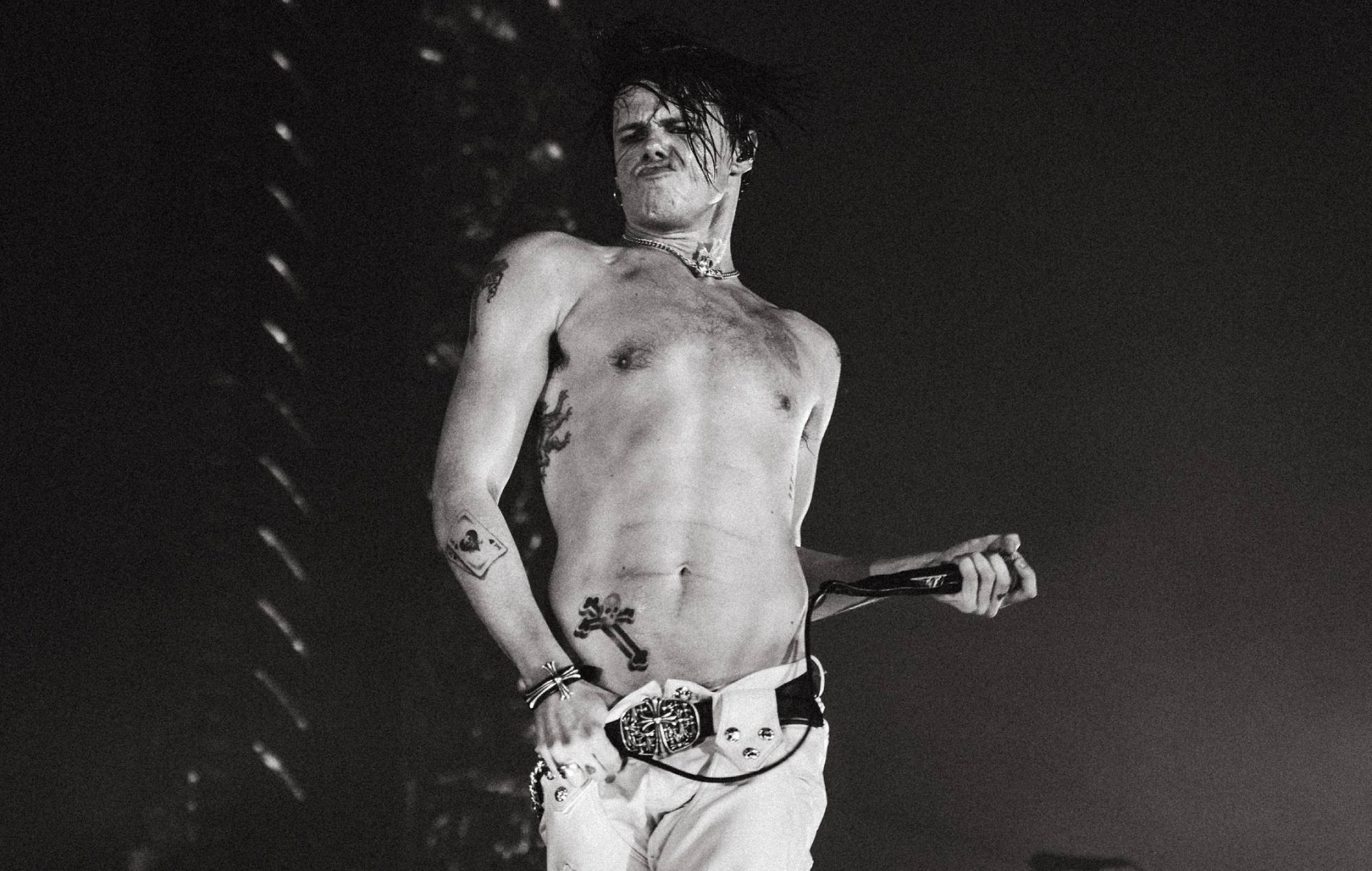 Yungblud breaks his leg in motorbike accident, vows to still play European festivals this week